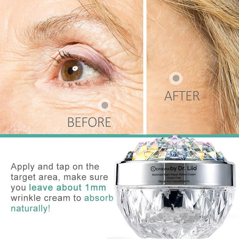 Anti-Aging Retinol Night Moisturizer for Radiant Skin