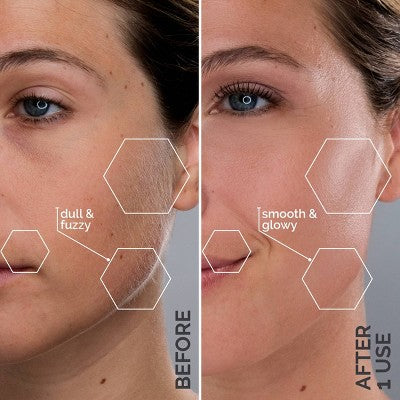 Herramienta de dermaplaning sónico SIMA Deluxe de Spa Sciences para exfoliación y eliminación de vello facial - Imperfect Box