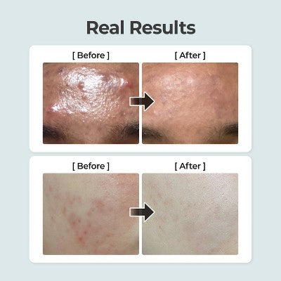 numbuzin No.1 Pure-Full Calming Herb Toner 10.14 fl oz - New