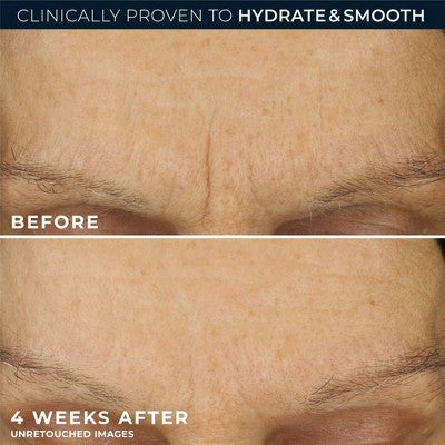 RoC Retinol Correxion Line Smoothing Max Hydration Cream 1.7oz - Imperfect Box