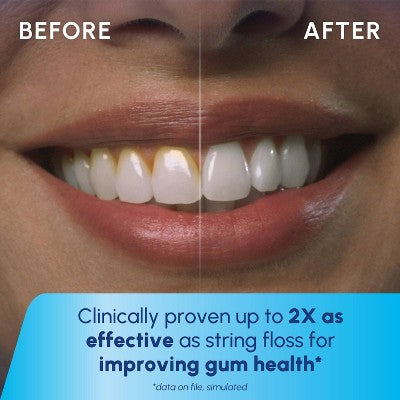 Irrigador dental Waterpik Cordlss Plus - Caja imperfecta