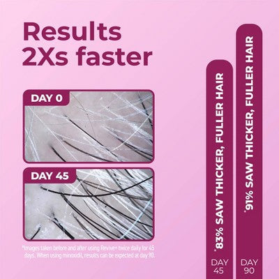 BosleyMD Revive + Suero Densificador para el Crecimiento del Cabello para Mujeres 1 fl oz - Caja Imperfect
