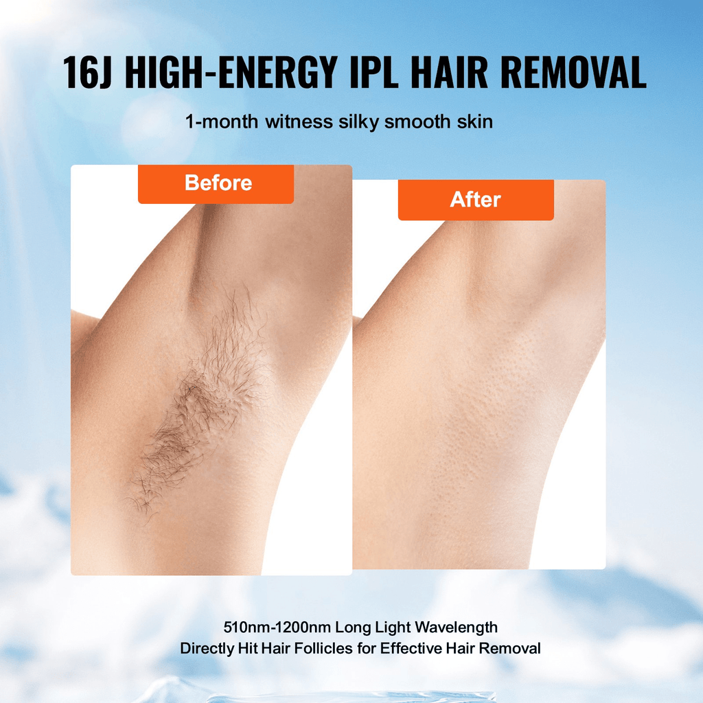 VEVOR IPL Hair Removal Device with Ice Cooling – Painless & Customizable for Full-Body Use